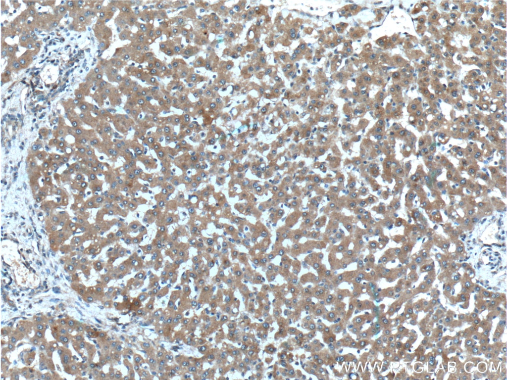 Immunohistochemistry (IHC) staining of human liver tissue using F2R Polyclonal antibody (26366-1-AP)