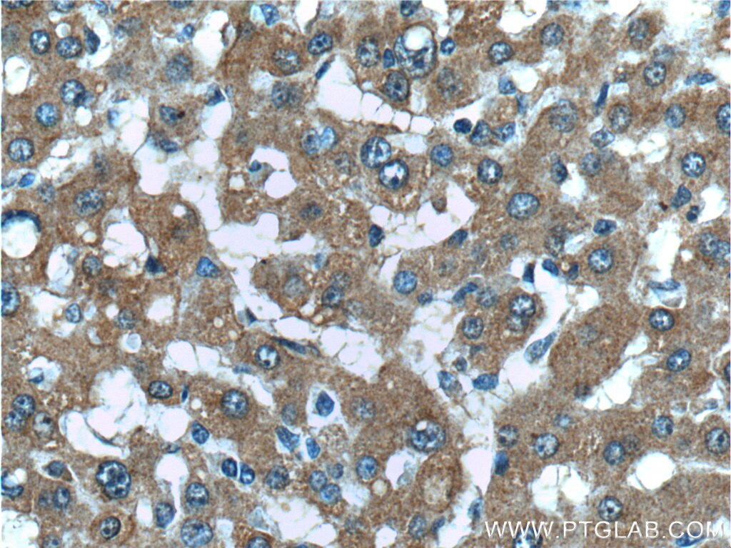 Immunohistochemistry (IHC) staining of human liver tissue using PAR1/Thrombin Receptor Polyclonal antibody (26366-1-AP)