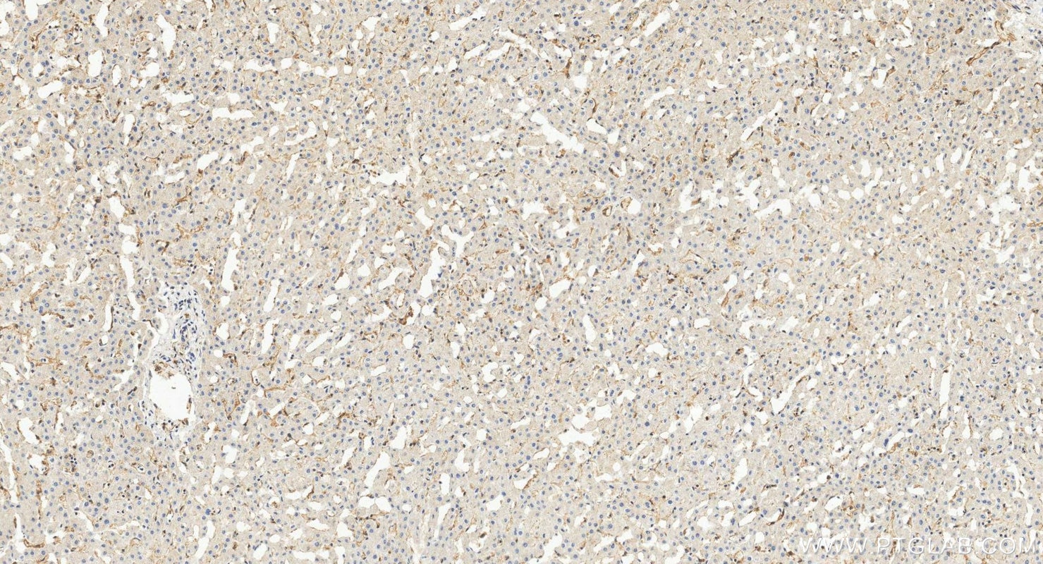 IHC staining of human liver using 26366-1-AP Immunohistochemistry (IHC) staining of human liver tissue using PAR1/Thrombin Receptor Polyclonal antibody (26366-1-AP)