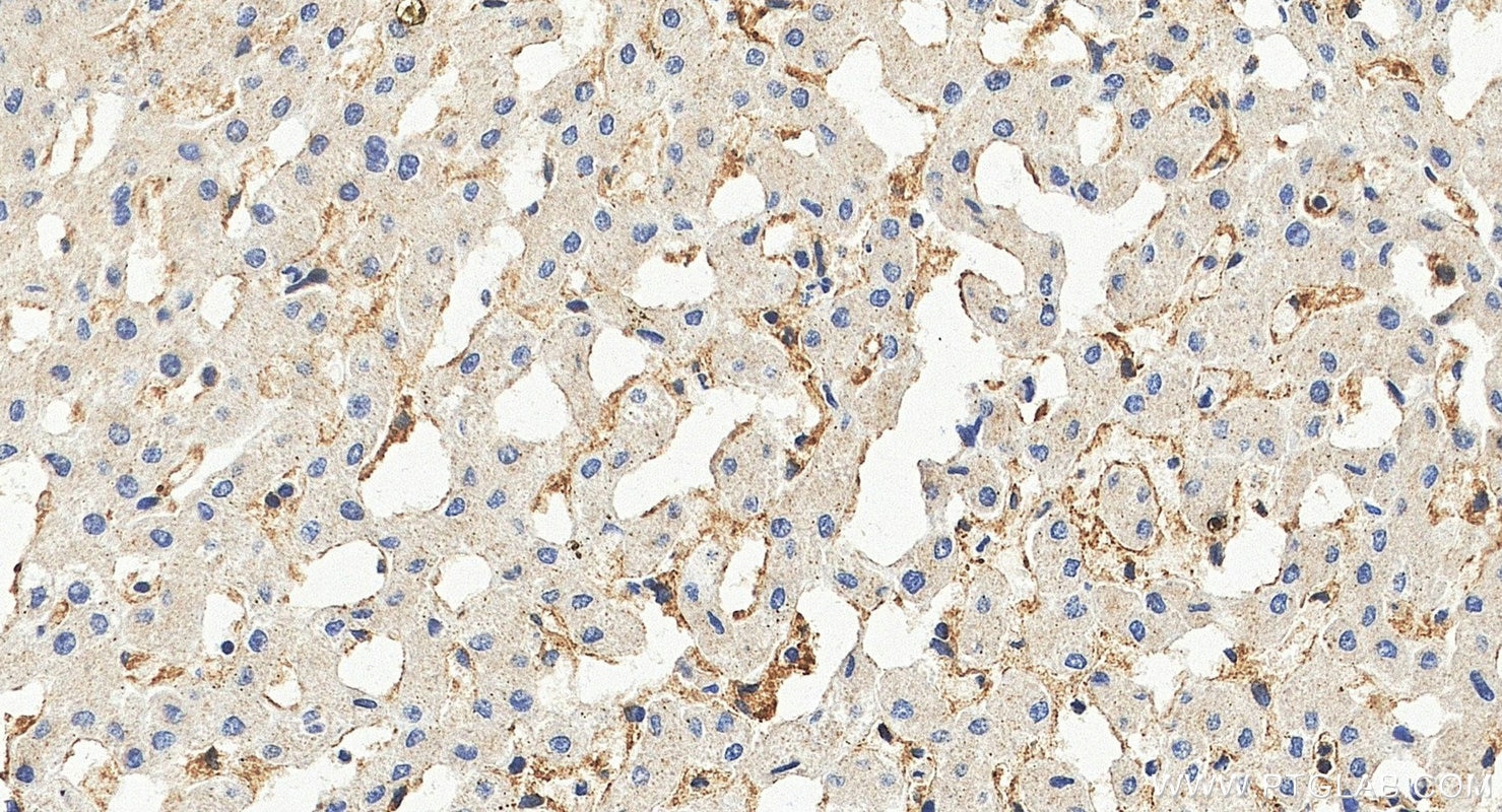IHC staining of human liver using 26366-1-AP Immunohistochemistry (IHC) staining of human liver tissue using PAR1/Thrombin Receptor Polyclonal antibody (26366-1-AP)