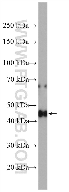 Western Blot (WB) analysis of mouse liver tissue using PAR1/Thrombin Receptor Polyclonal antibody (26366-1-AP)