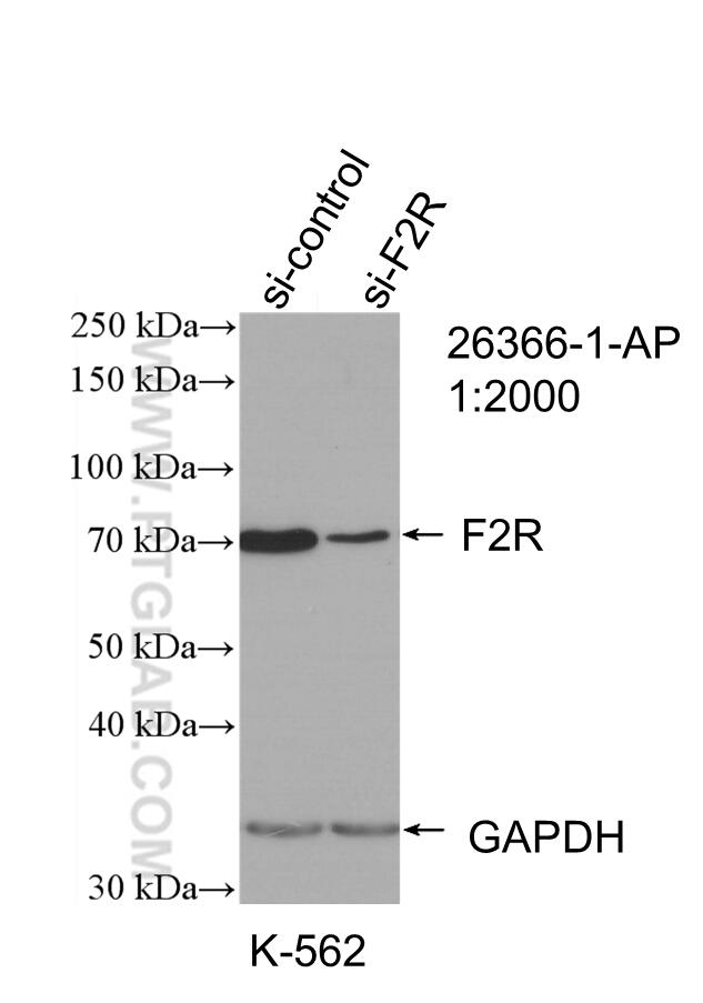 Western Blot (WB) analysis of K-562 cells using PAR1/Thrombin Receptor Polyclonal antibody (26366-1-AP)