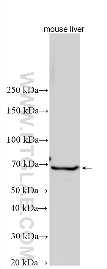 WB analysis using 26366-1-AP Western Blot (WB) analysis of various lysates using PAR1/Thrombin Receptor Polyclonal antibody (26366-1-AP)