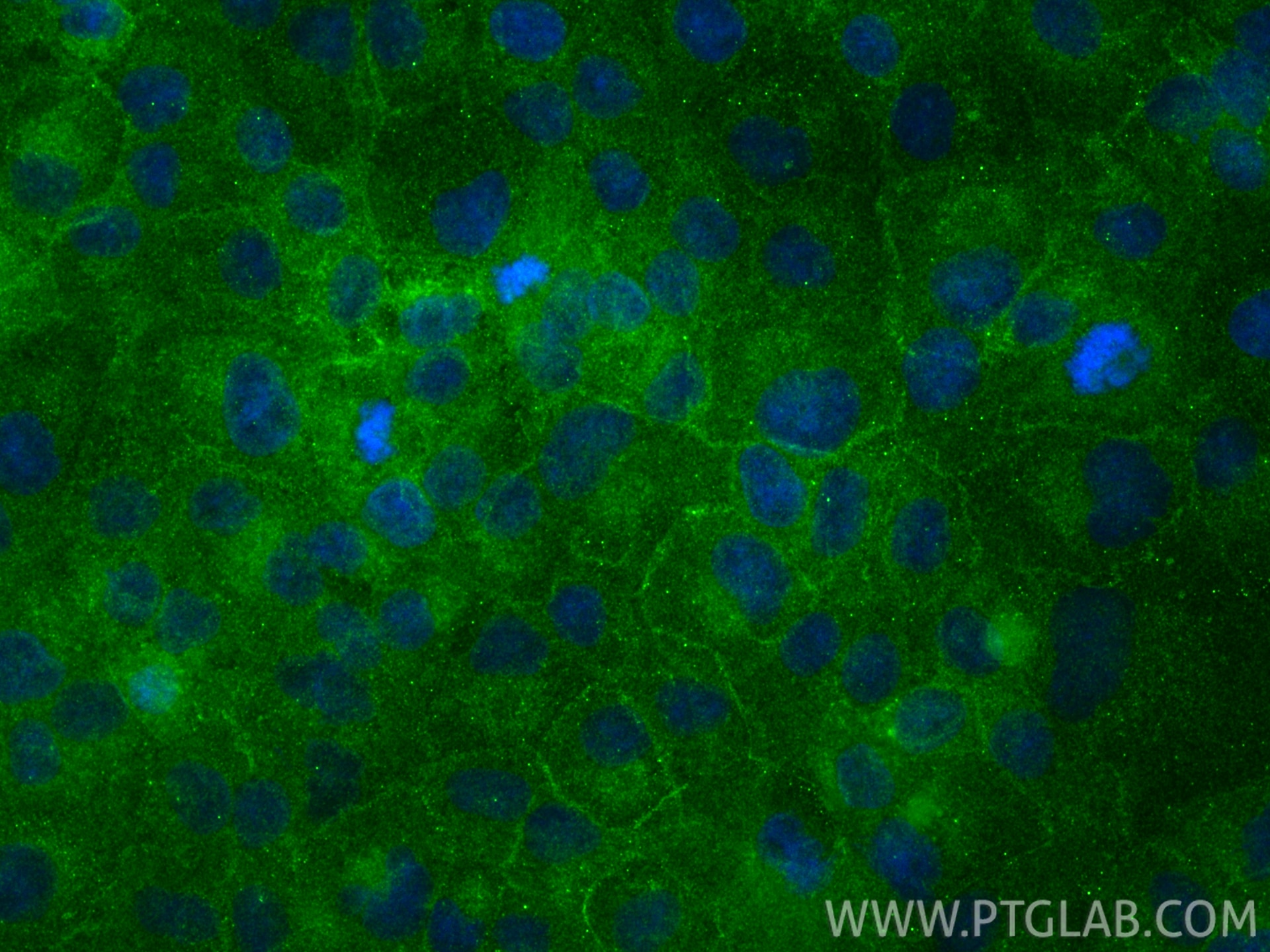 IF Staining of DU 145 using 12160-1-AP Immunofluorescence (IF) / fluorescent staining of DU 145 cells using PAR2 Polyclonal antibody (12160-1-AP)