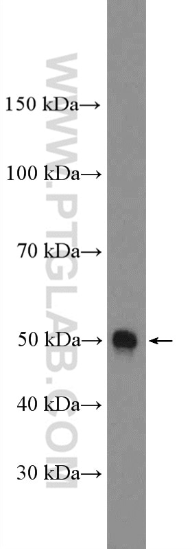 Western Blot (WB) analysis of COLO 320 cells using PAR2 Polyclonal antibody (12160-1-AP)