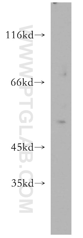 PAR2 Polyclonal antibody