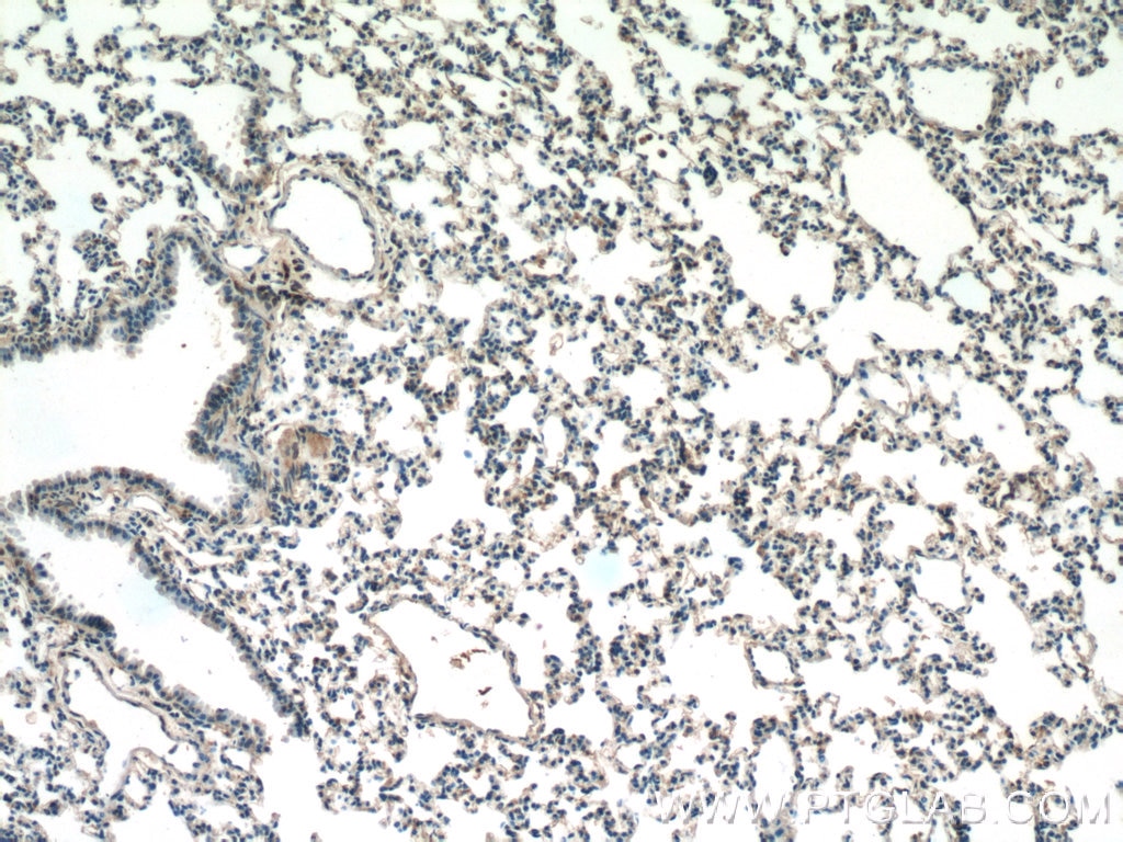 Immunohistochemistry (IHC) staining of mouse lung tissue using F2RL3 Polyclonal antibody (25306-1-AP)