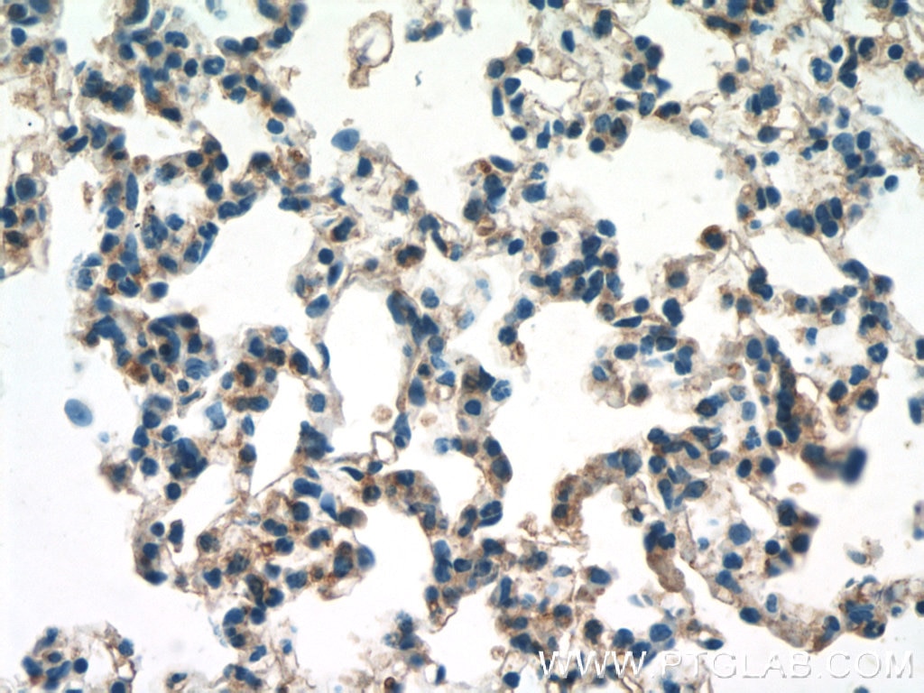 Immunohistochemistry (IHC) staining of mouse lung tissue using F2RL3 Polyclonal antibody (25306-1-AP)