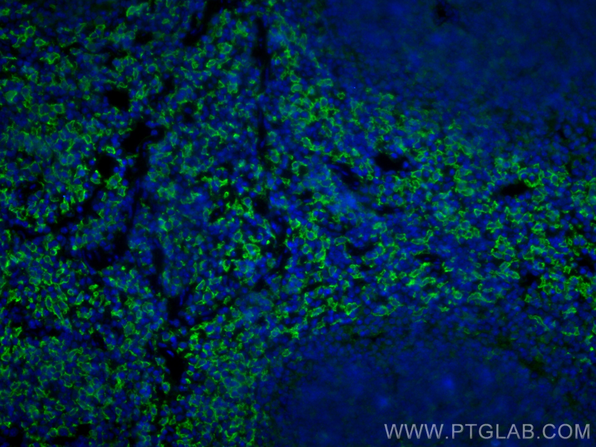 Immunofluorescence (IF) / fluorescent staining of mouse spleen tissue using F4/80 Polyclonal antibody (28463-1-AP)