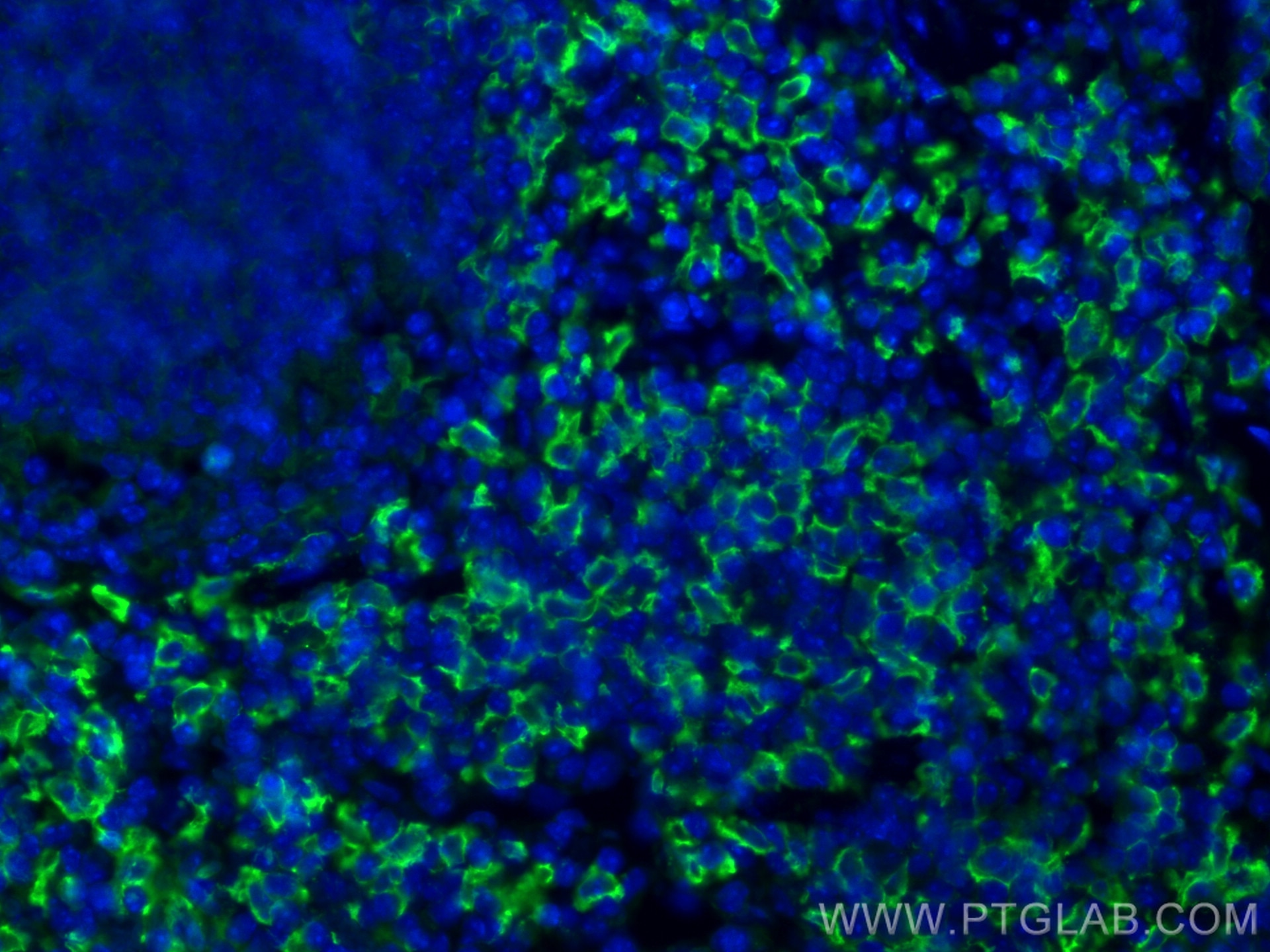 Immunofluorescence (IF) / fluorescent staining of mouse spleen tissue using F4/80 Polyclonal antibody (28463-1-AP)