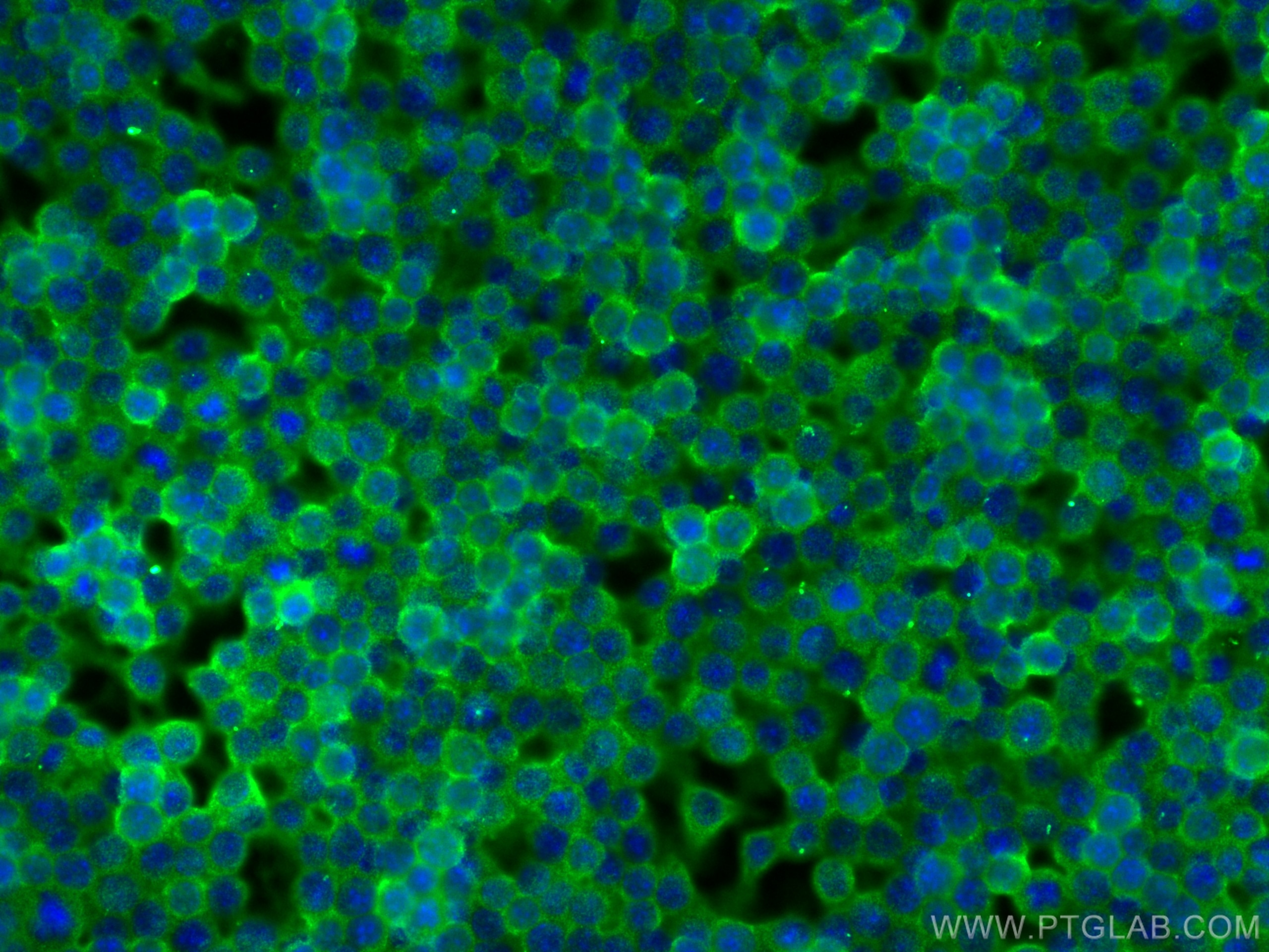 Immunofluorescence (IF) / fluorescent staining of RAW 264.7 cells using F4/80 Polyclonal antibody (28463-1-AP)