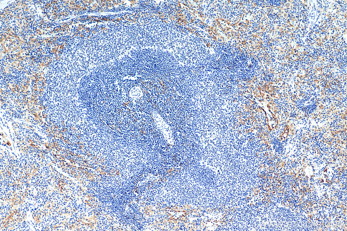 Immunohistochemistry (IHC) staining of rat spleen tissue using F4/80 Polyclonal antibody (28463-1-AP)