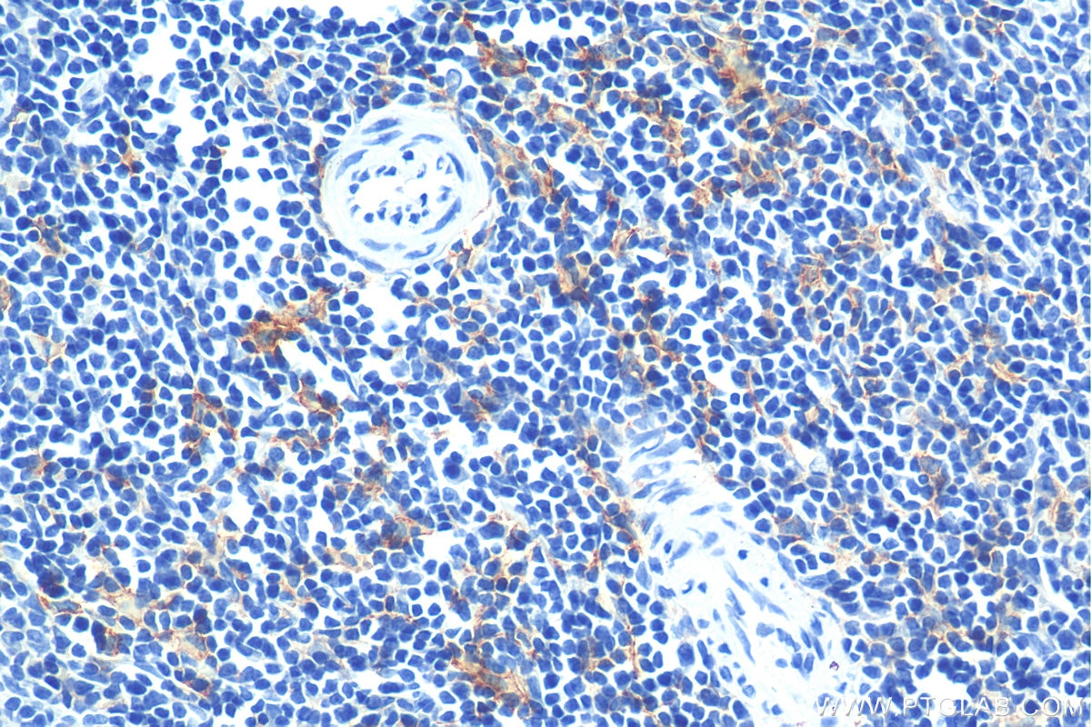 Immunohistochemistry (IHC) staining of rat spleen tissue using F4/80 Polyclonal antibody (28463-1-AP)