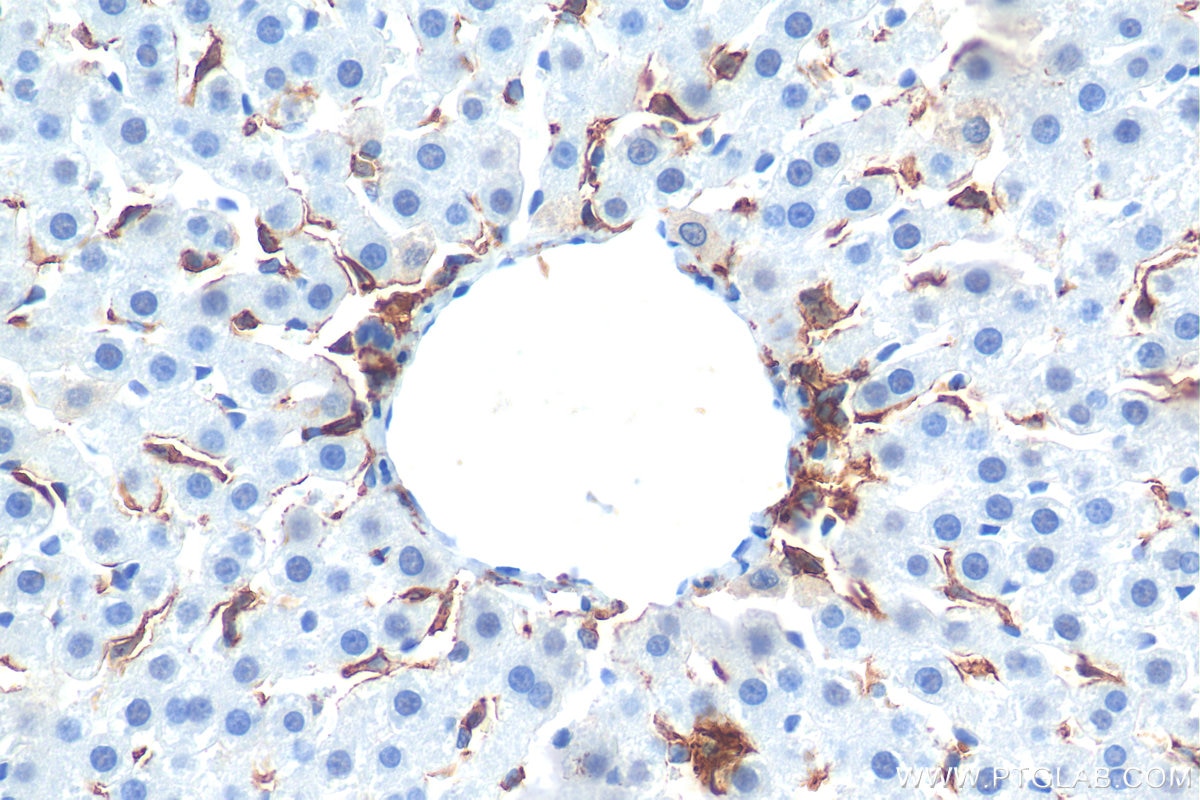 IHC staining of rat liver using 28463-1-AP