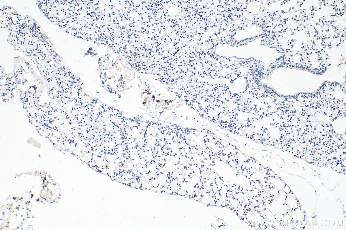 Immunohistochemistry (IHC) staining of mouse lung tissue using F4/80 Polyclonal antibody (28463-1-AP)