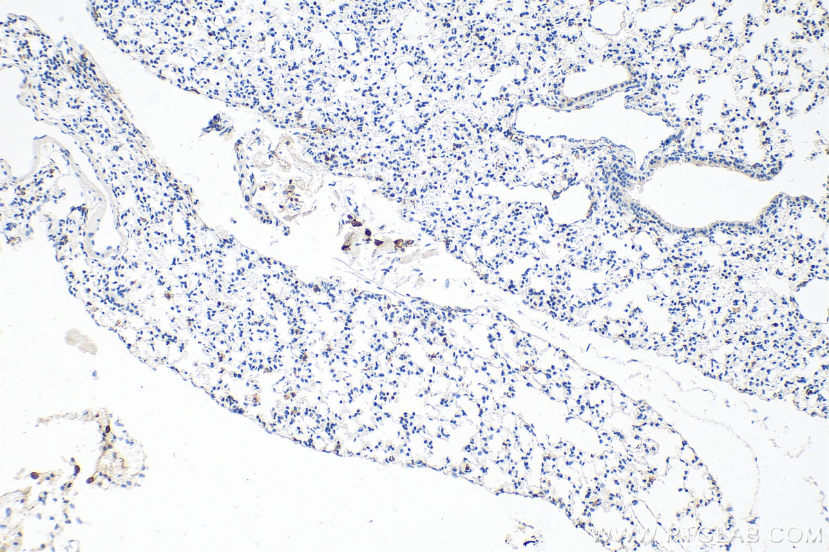 IHC staining of mouse lung using 28463-1-AP