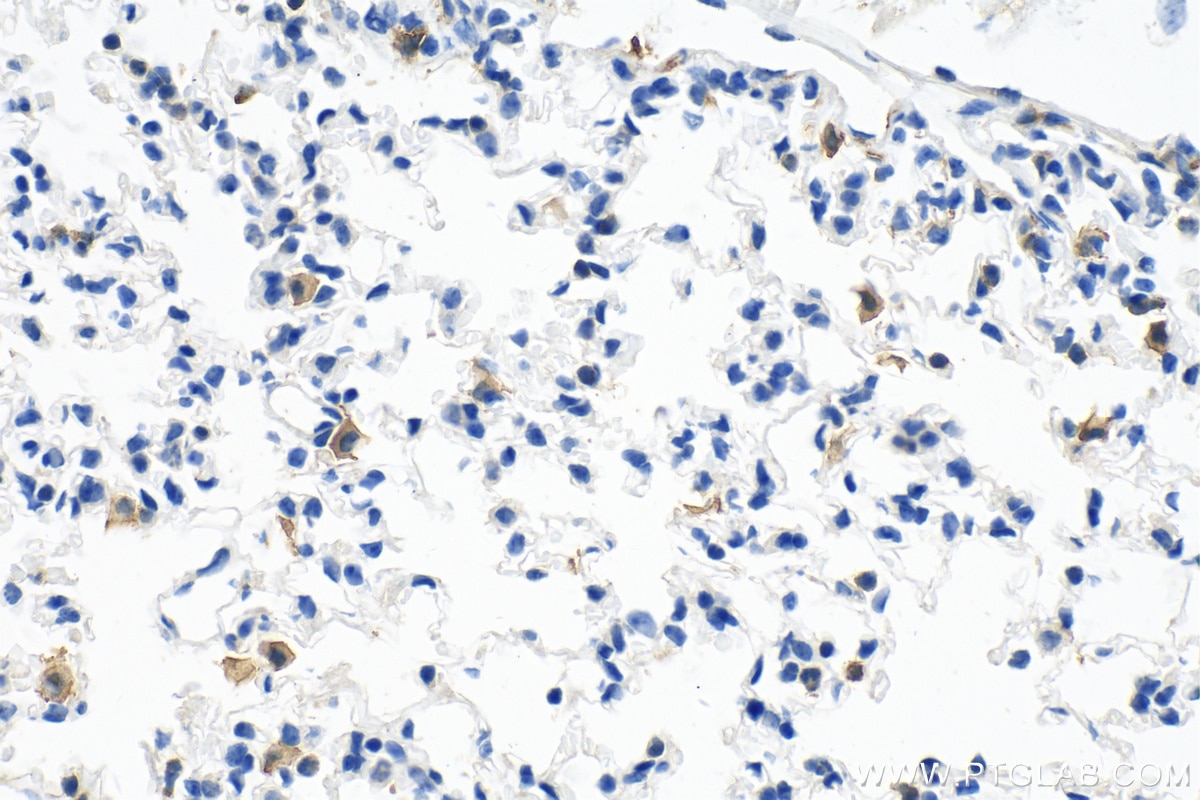 Immunohistochemistry (IHC) staining of mouse lung tissue using F4/80 Polyclonal antibody (28463-1-AP)