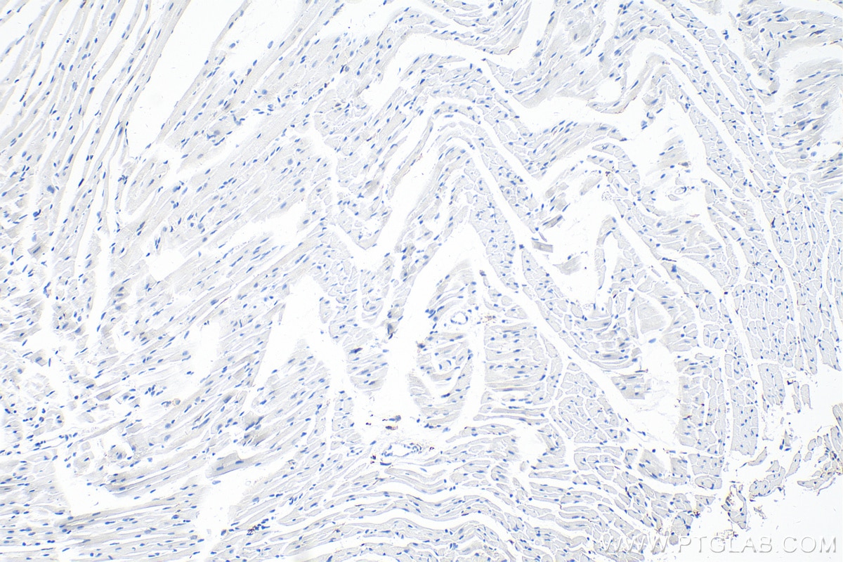 Immunohistochemistry (IHC) staining of mouse heart tissue using F4/80 Polyclonal antibody (28463-1-AP)