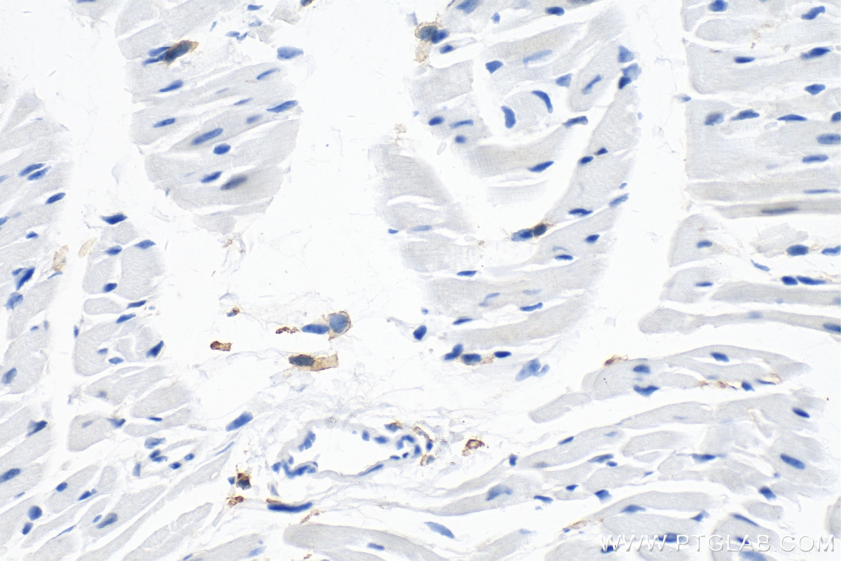 Immunohistochemistry (IHC) staining of mouse heart tissue using F4/80 Polyclonal antibody (28463-1-AP)