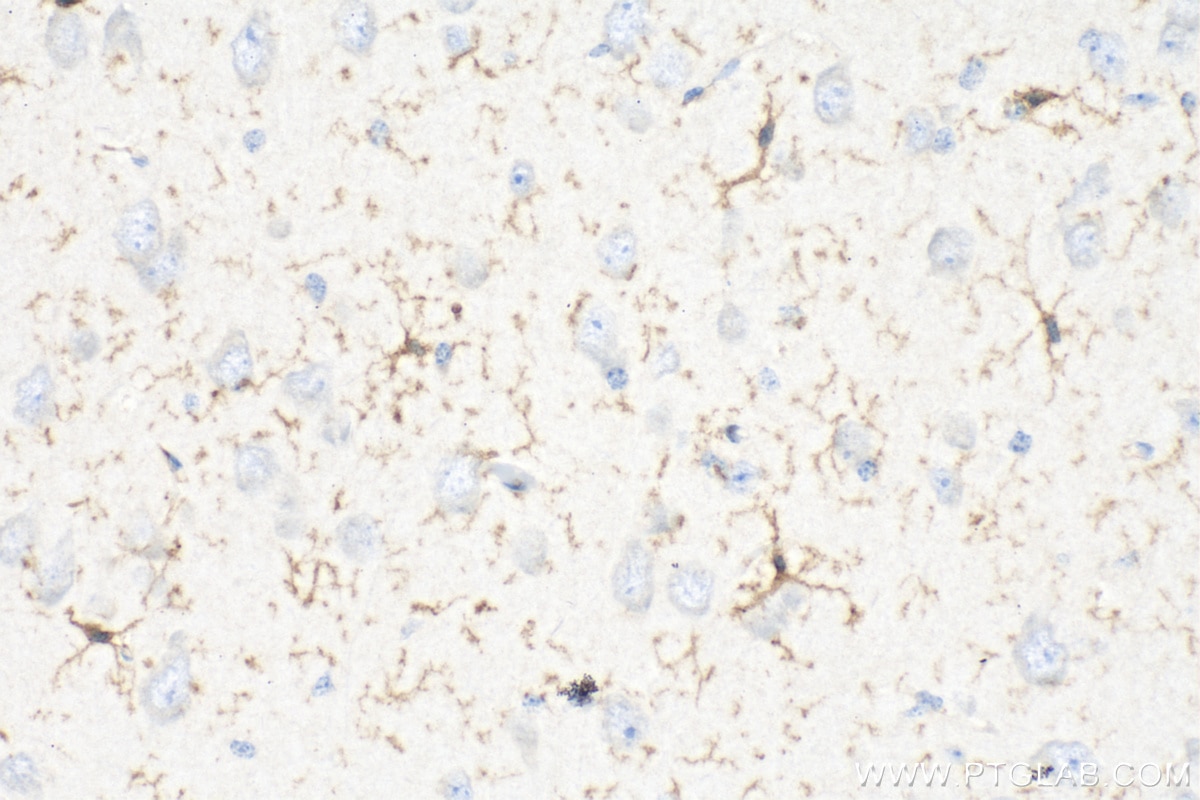 Immunohistochemistry (IHC) staining of mouse brain tissue using F4/80 Polyclonal antibody (28463-1-AP)