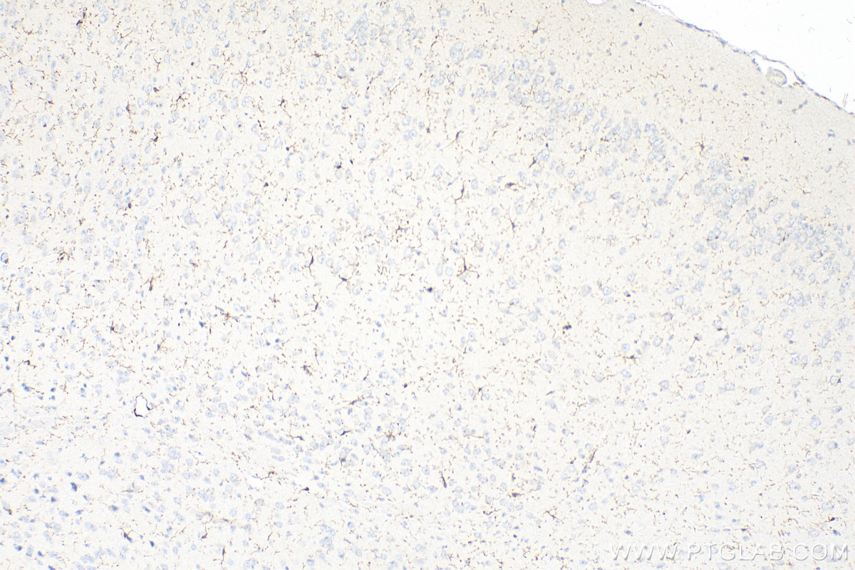 IHC staining of mouse brain using 28463-1-AP