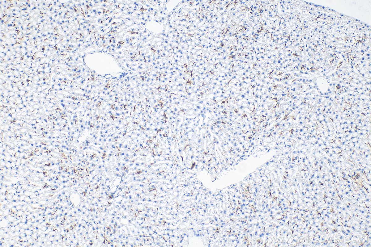 Immunohistochemistry (IHC) staining of mouse liver tissue using F4/80 Polyclonal antibody (28463-1-AP)