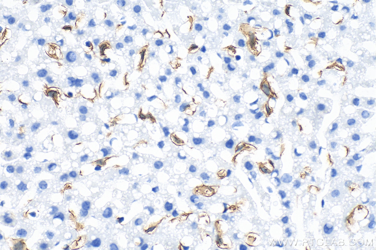 IHC staining of mouse liver using 28463-1-AP