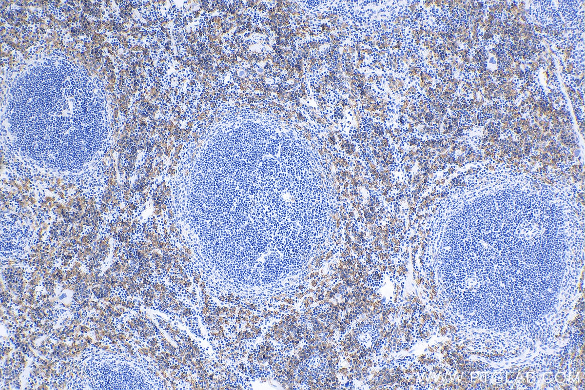 Immunohistochemistry (IHC) staining of mouse spleen tissue using F4/80 Polyclonal antibody (28463-1-AP)