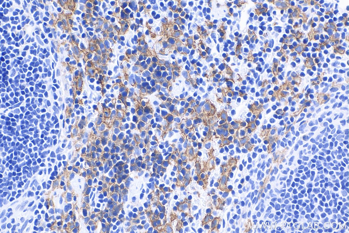 Immunohistochemistry (IHC) staining of mouse spleen tissue using F4/80 Polyclonal antibody (28463-1-AP)