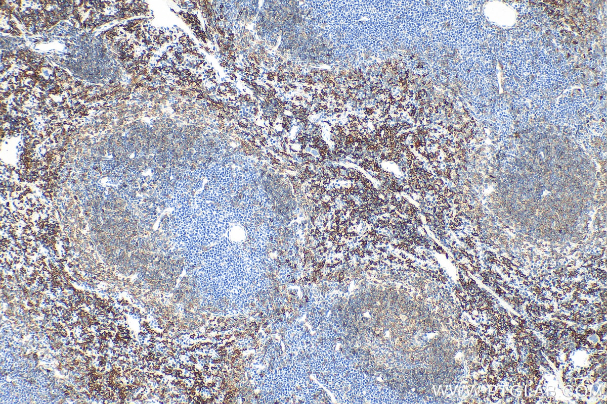 Immunohistochemistry (IHC) staining of mouse spleen tissue using F4/80 Polyclonal antibody (28463-1-AP)