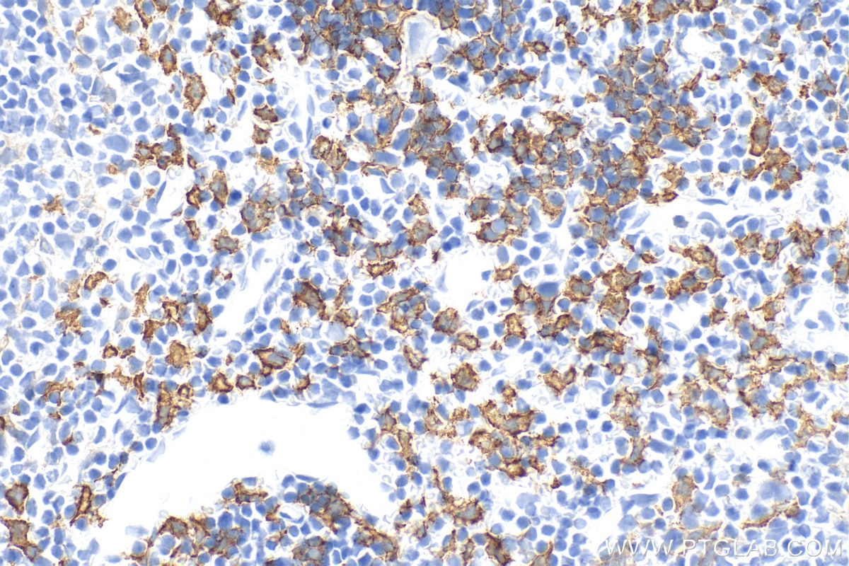 Immunohistochemistry (IHC) staining of mouse spleen tissue using F4/80 Polyclonal antibody (28463-1-AP)