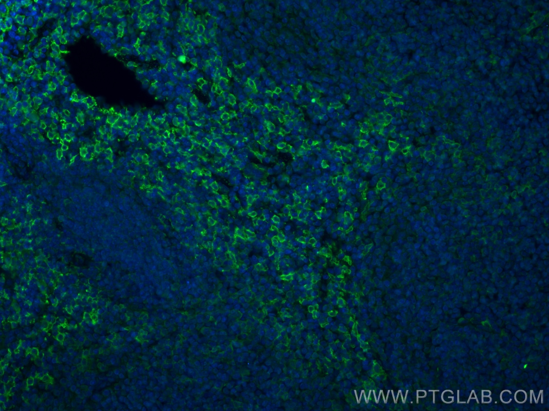 IF Staining of mouse spleen using 29414-1-AP