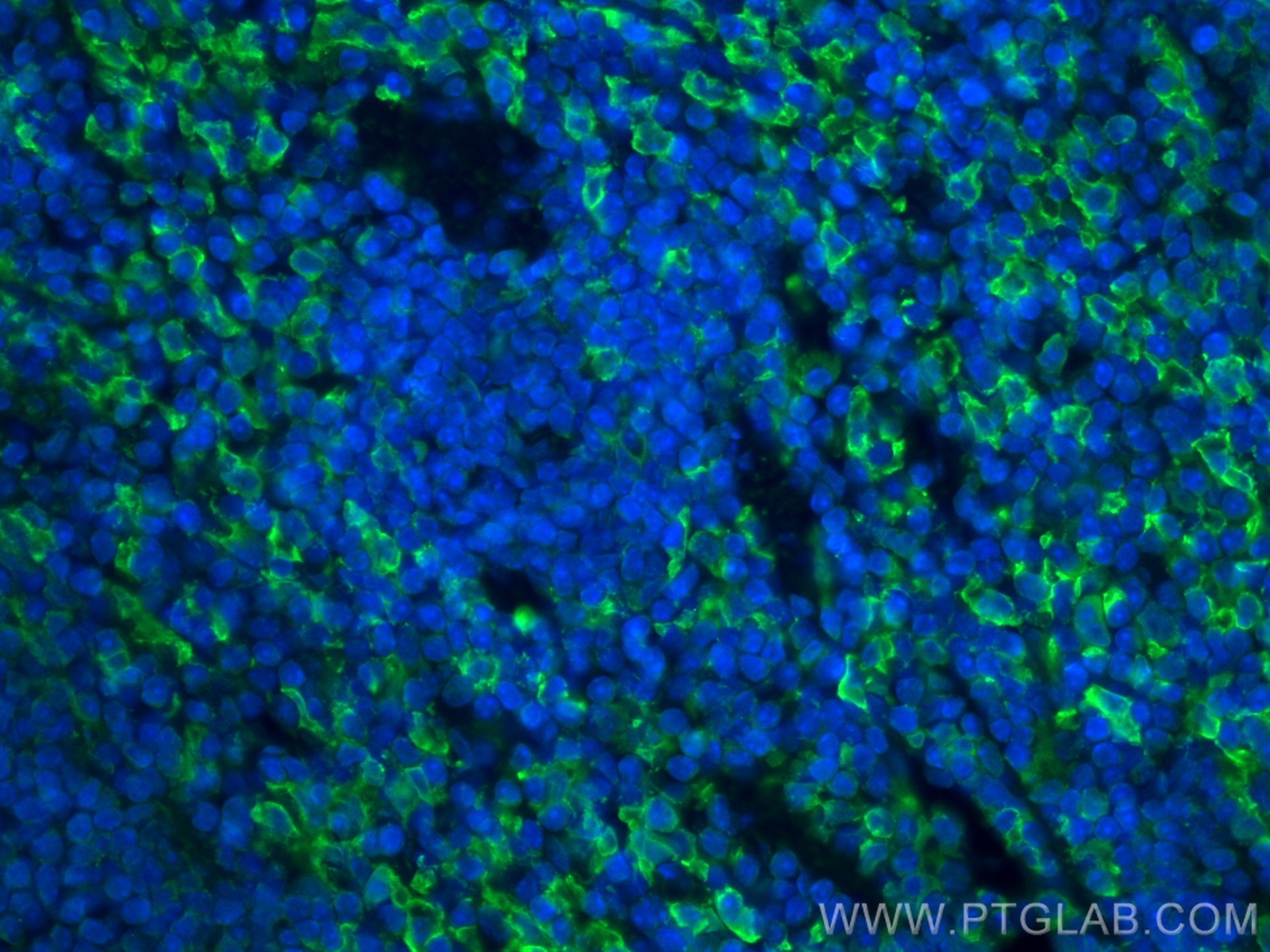 Immunofluorescence (IF) / fluorescent staining of mouse spleen tissue using F4/80 Polyclonal antibody (29414-1-AP)