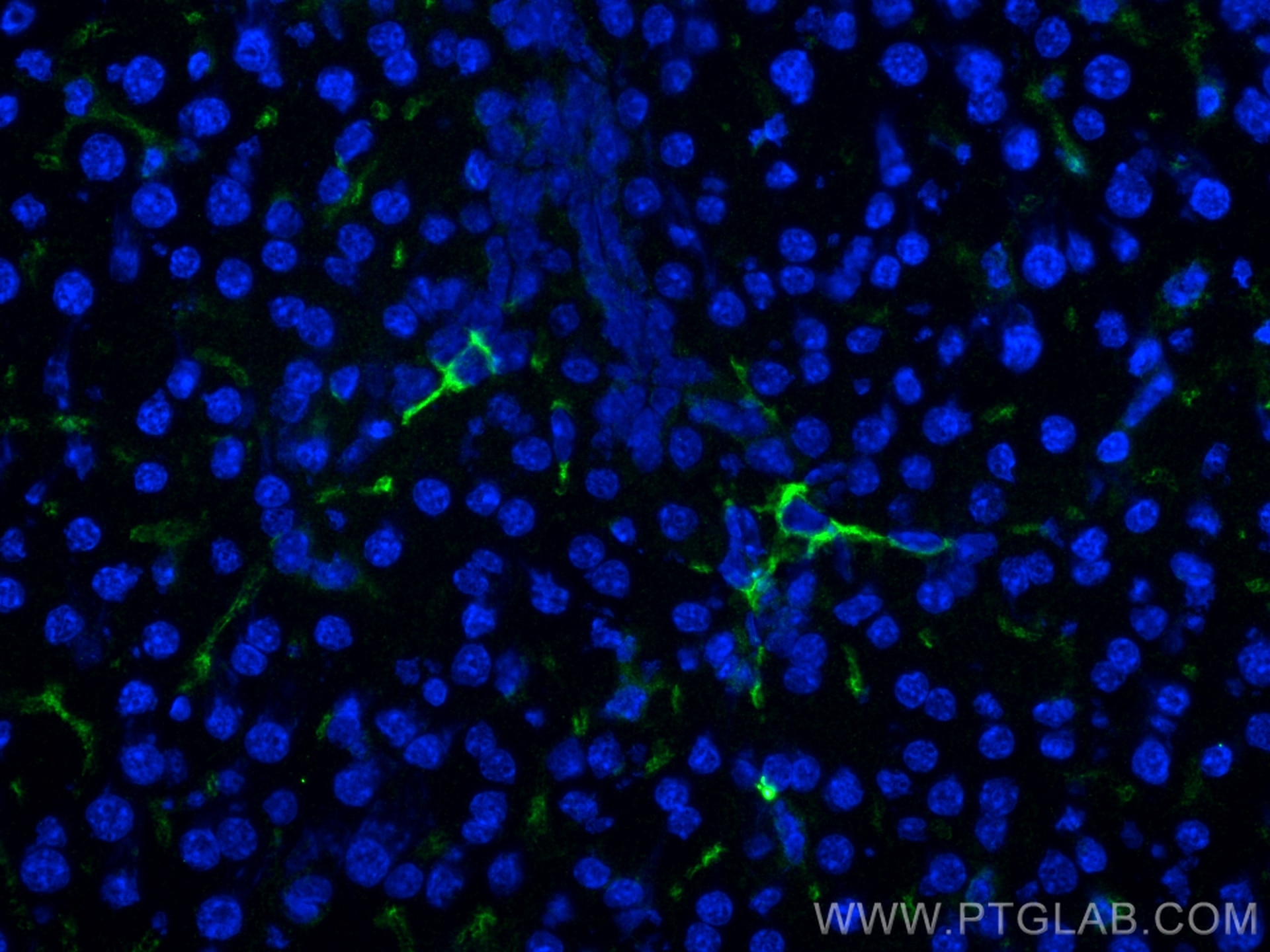 Immunofluorescence (IF) / fluorescent staining of mouse liver tissue using F4/80 Polyclonal antibody (29414-1-AP)