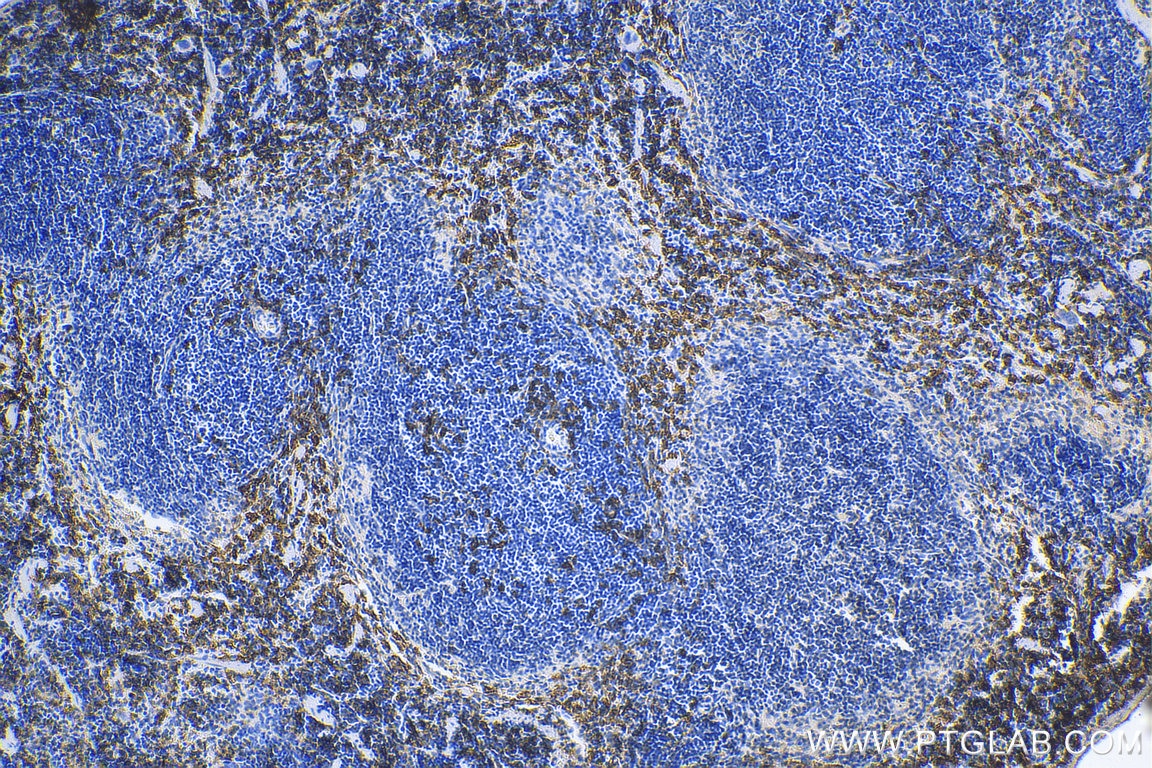 Immunohistochemistry (IHC) staining of mouse spleen tissue using F4/80 Polyclonal antibody (29414-1-AP)