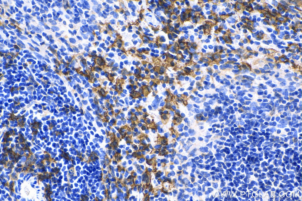 Immunohistochemistry (IHC) staining of mouse spleen tissue using F4/80 Polyclonal antibody (29414-1-AP)