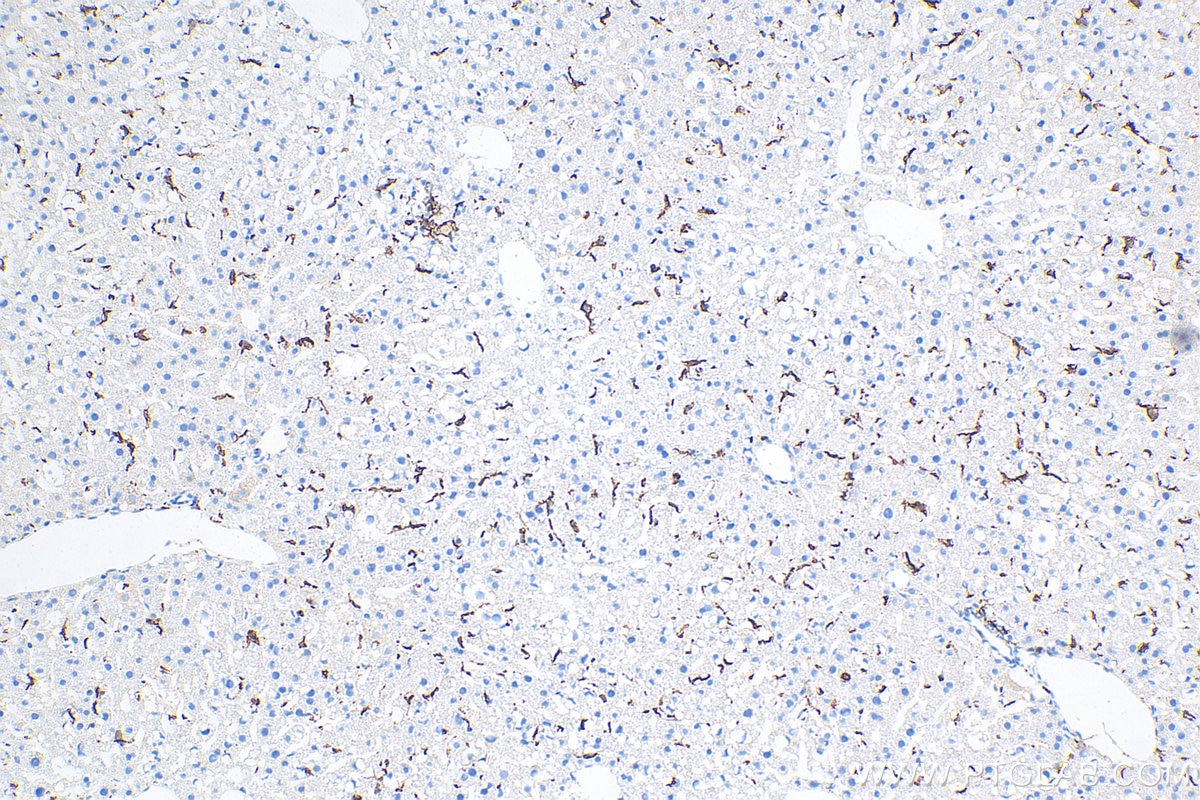 Immunohistochemistry (IHC) staining of mouse liver tissue using F4/80 Polyclonal antibody (29414-1-AP)