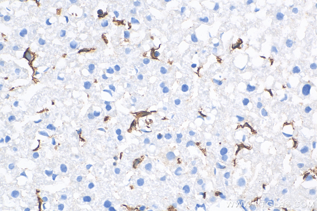 Immunohistochemistry (IHC) staining of mouse liver tissue using F4/80 Polyclonal antibody (29414-1-AP)