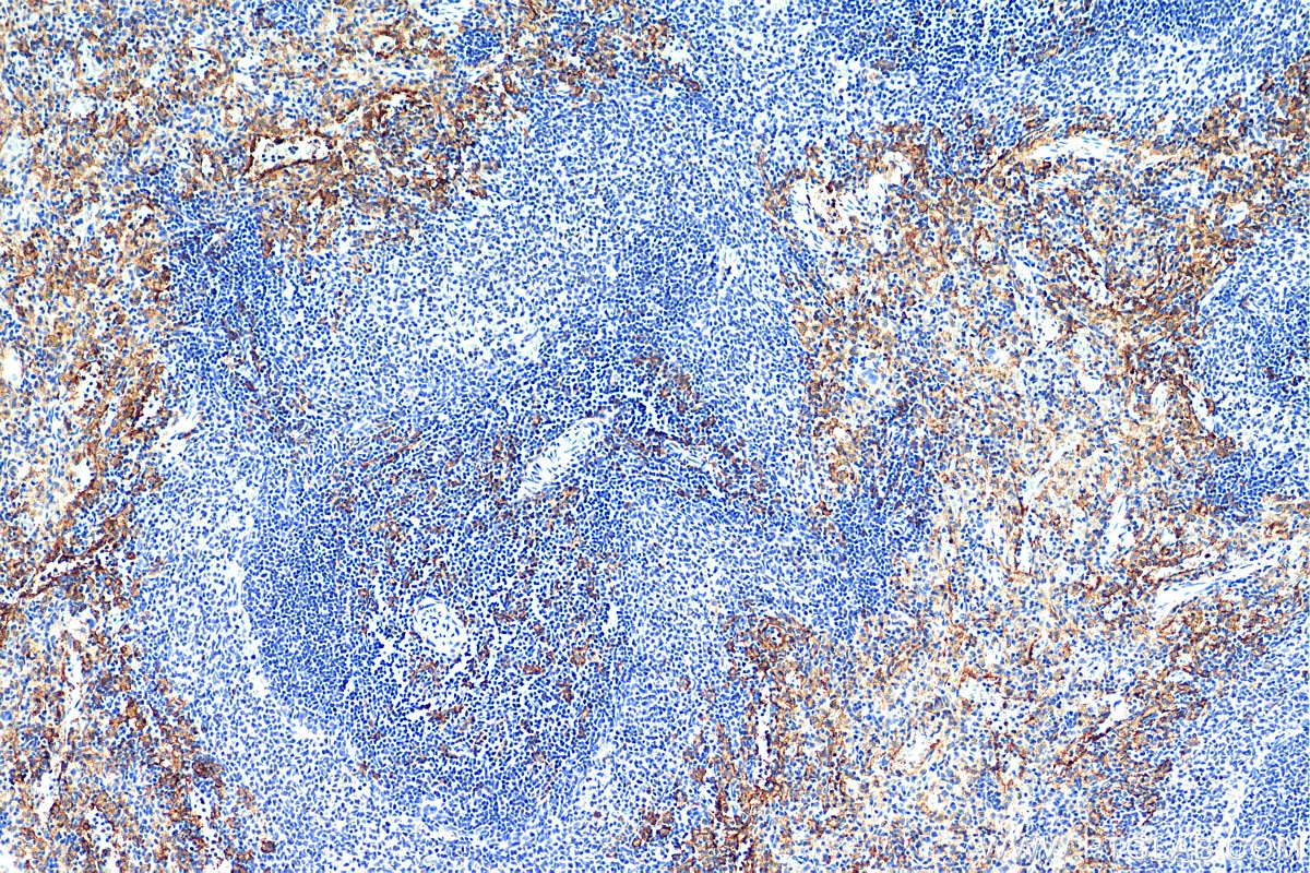 Immunohistochemistry (IHC) staining of rat spleen tissue using F4/80 Polyclonal antibody (29414-1-AP)