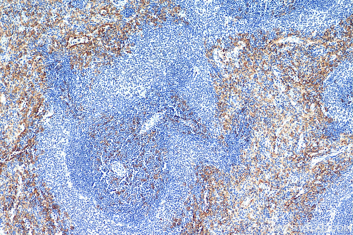 Immunohistochemistry (IHC) staining of rat spleen tissue using F4/80 Polyclonal antibody (29414-1-AP)