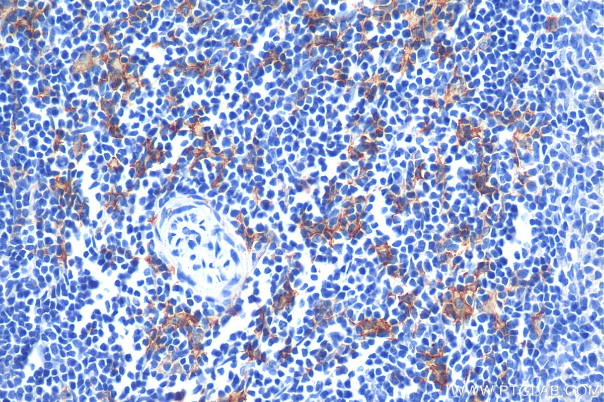 Immunohistochemistry (IHC) staining of rat spleen tissue using F4/80 Polyclonal antibody (29414-1-AP)