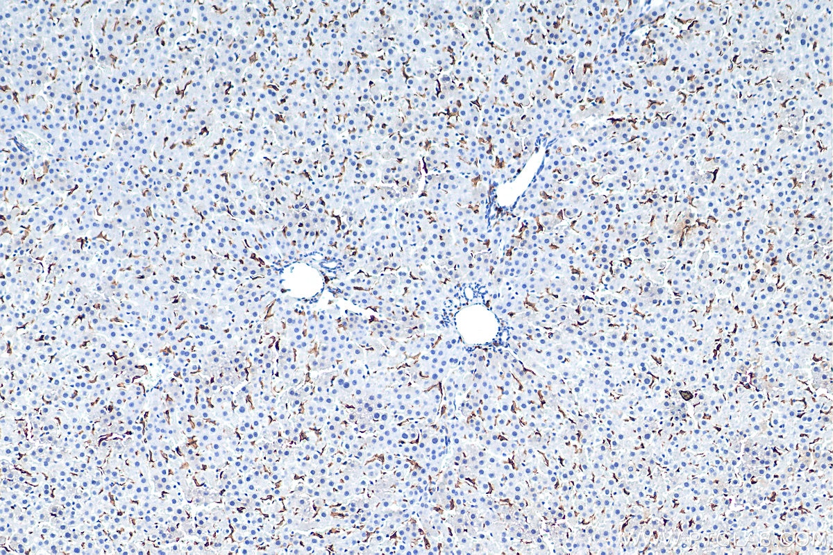 Immunohistochemistry (IHC) staining of rat liver tissue using F4/80 Polyclonal antibody (29414-1-AP)