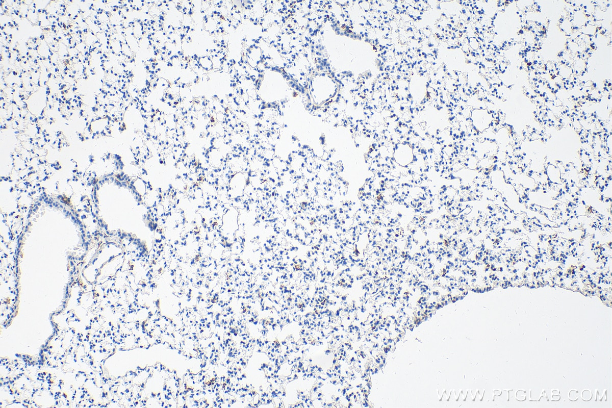 Immunohistochemistry (IHC) staining of mouse lung tissue using F4/80 Polyclonal antibody (29414-1-AP)