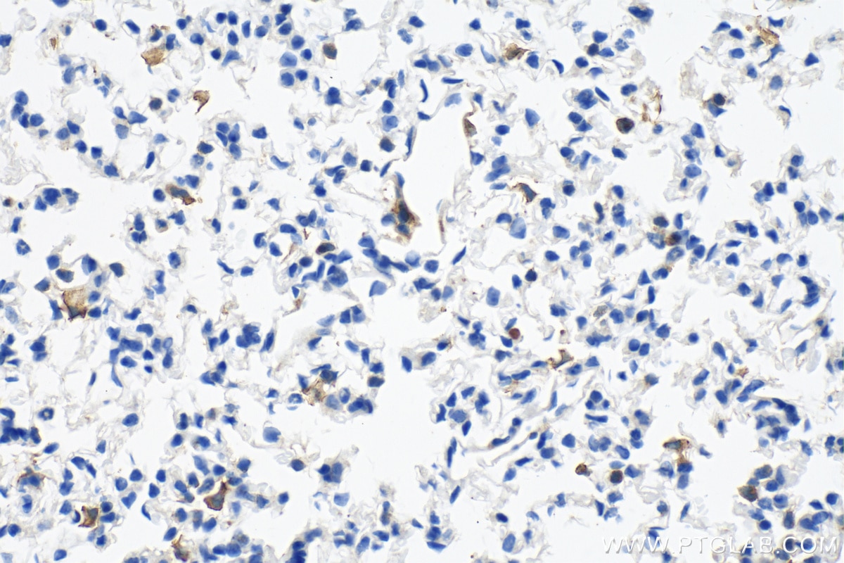 Immunohistochemistry (IHC) staining of mouse lung tissue using F4/80 Polyclonal antibody (29414-1-AP)