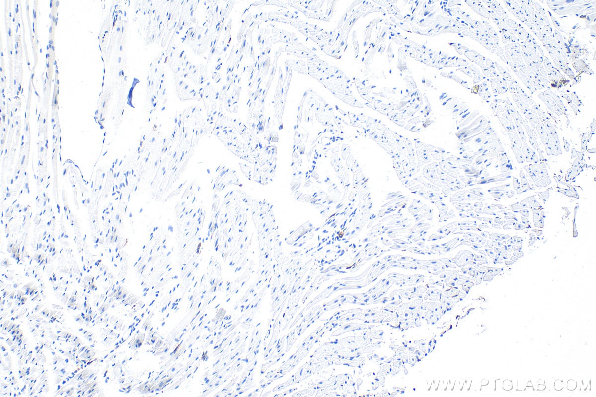 Immunohistochemistry (IHC) staining of mouse heart tissue using F4/80 Polyclonal antibody (29414-1-AP)