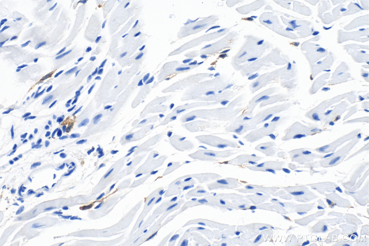 Immunohistochemistry (IHC) staining of mouse heart tissue using F4/80 Polyclonal antibody (29414-1-AP)
