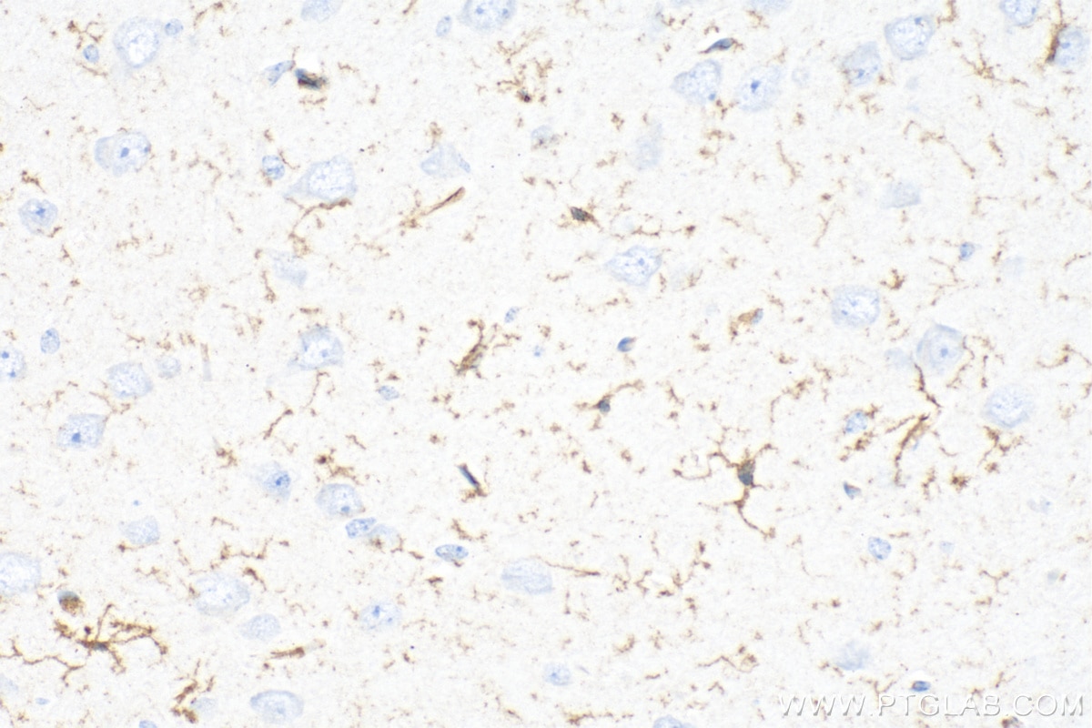 Immunohistochemistry (IHC) staining of mouse brain tissue using F4/80 Polyclonal antibody (29414-1-AP)