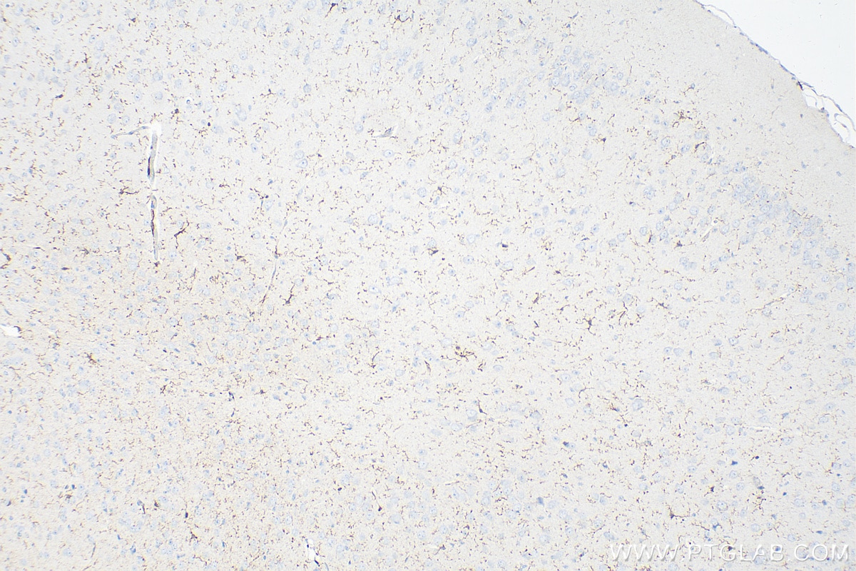 Immunohistochemistry (IHC) staining of mouse brain tissue using F4/80 Polyclonal antibody (29414-1-AP)