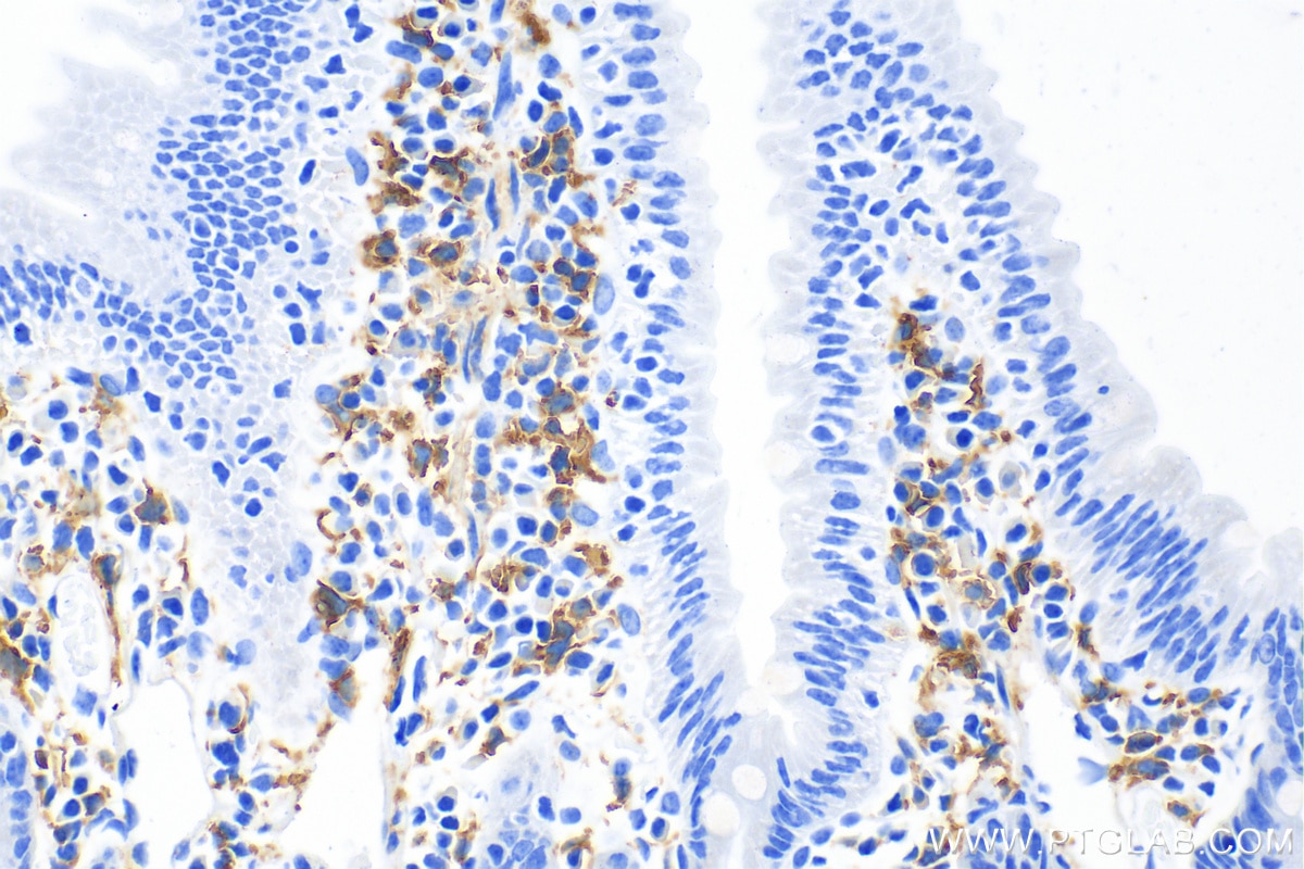 Immunohistochemistry (IHC) staining of mouse small intestine tissue using F4/80 Polyclonal antibody (29414-1-AP)
