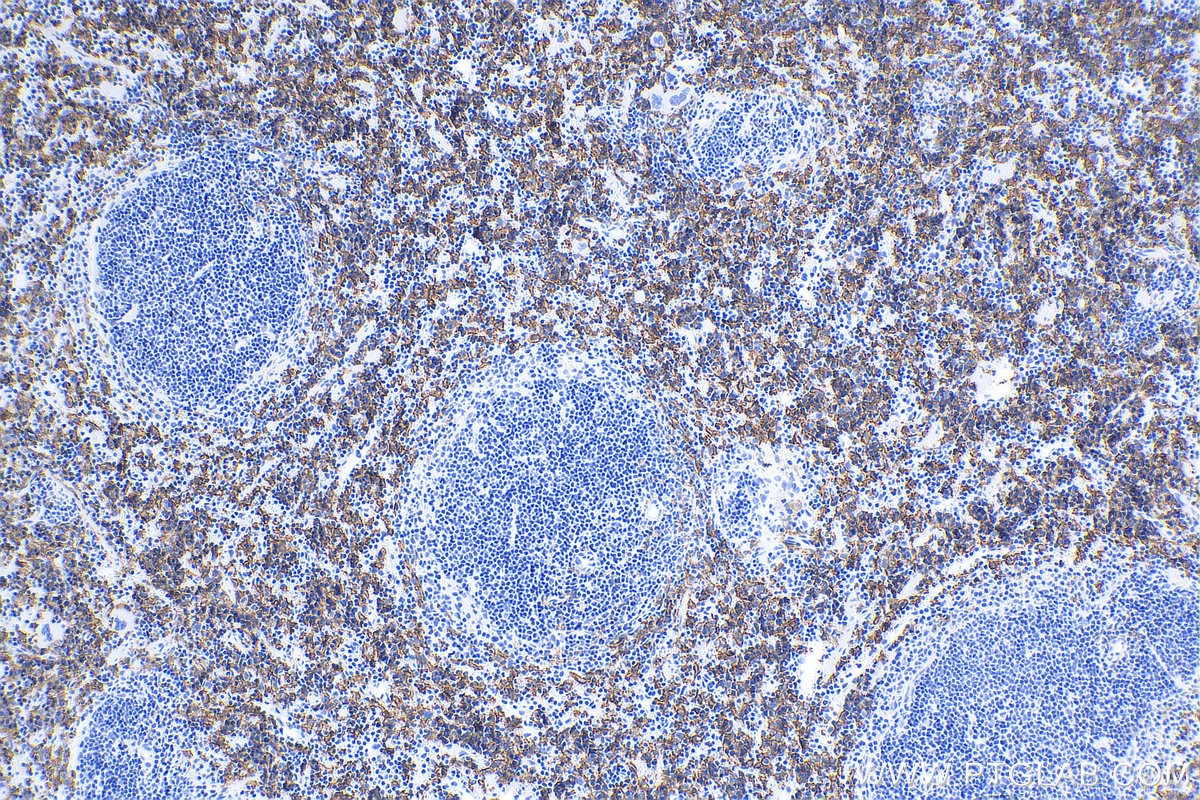 Immunohistochemistry (IHC) staining of mouse spleen tissue using F4/80 Polyclonal antibody (29414-1-AP)